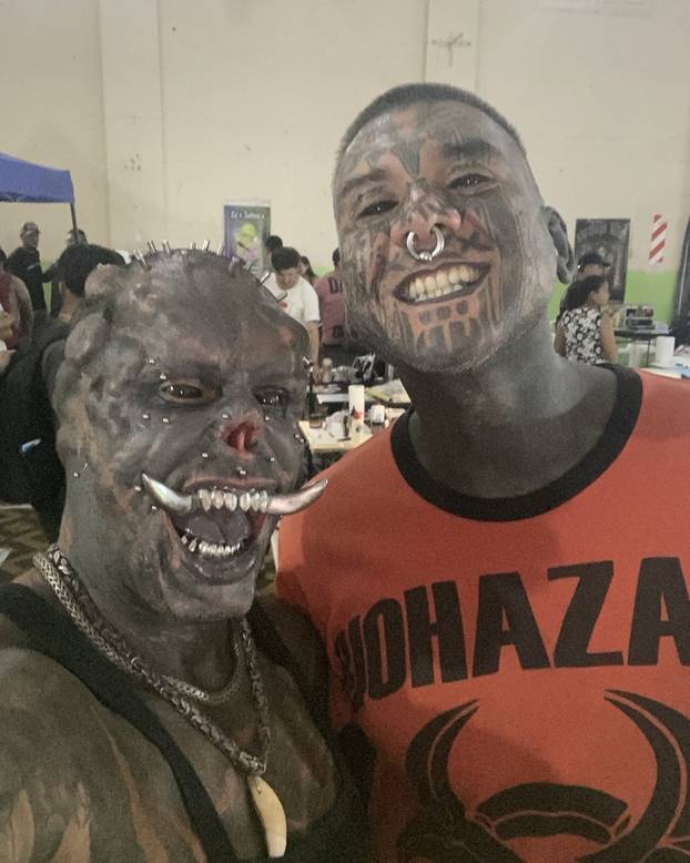 FOTO Uznemirujuće! Uklonila je čak i vrh nosa, a evo kako je izgledala: Šteta, ljepotica si bila