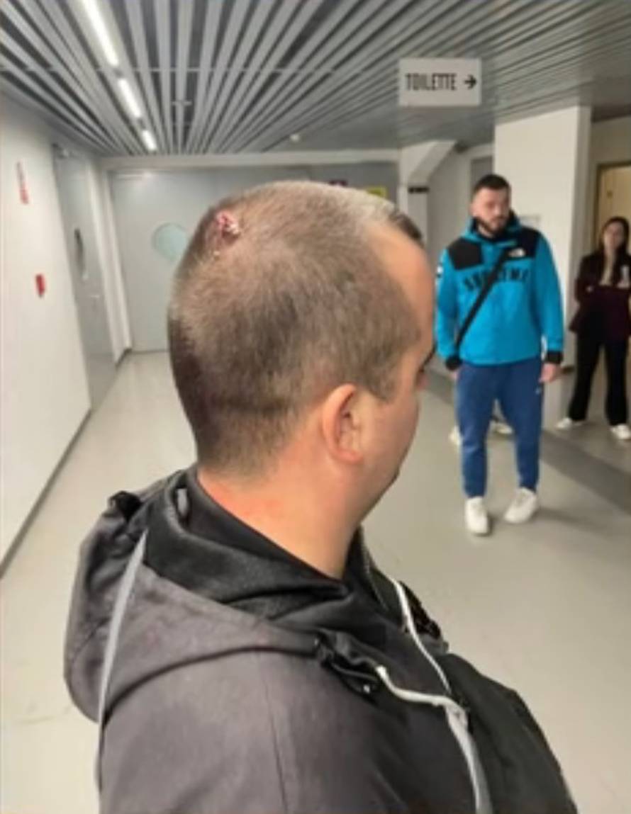 Srpska televizija objavila fotke pretučenih u Zadru. Policija je nastavila privoditi umiješane