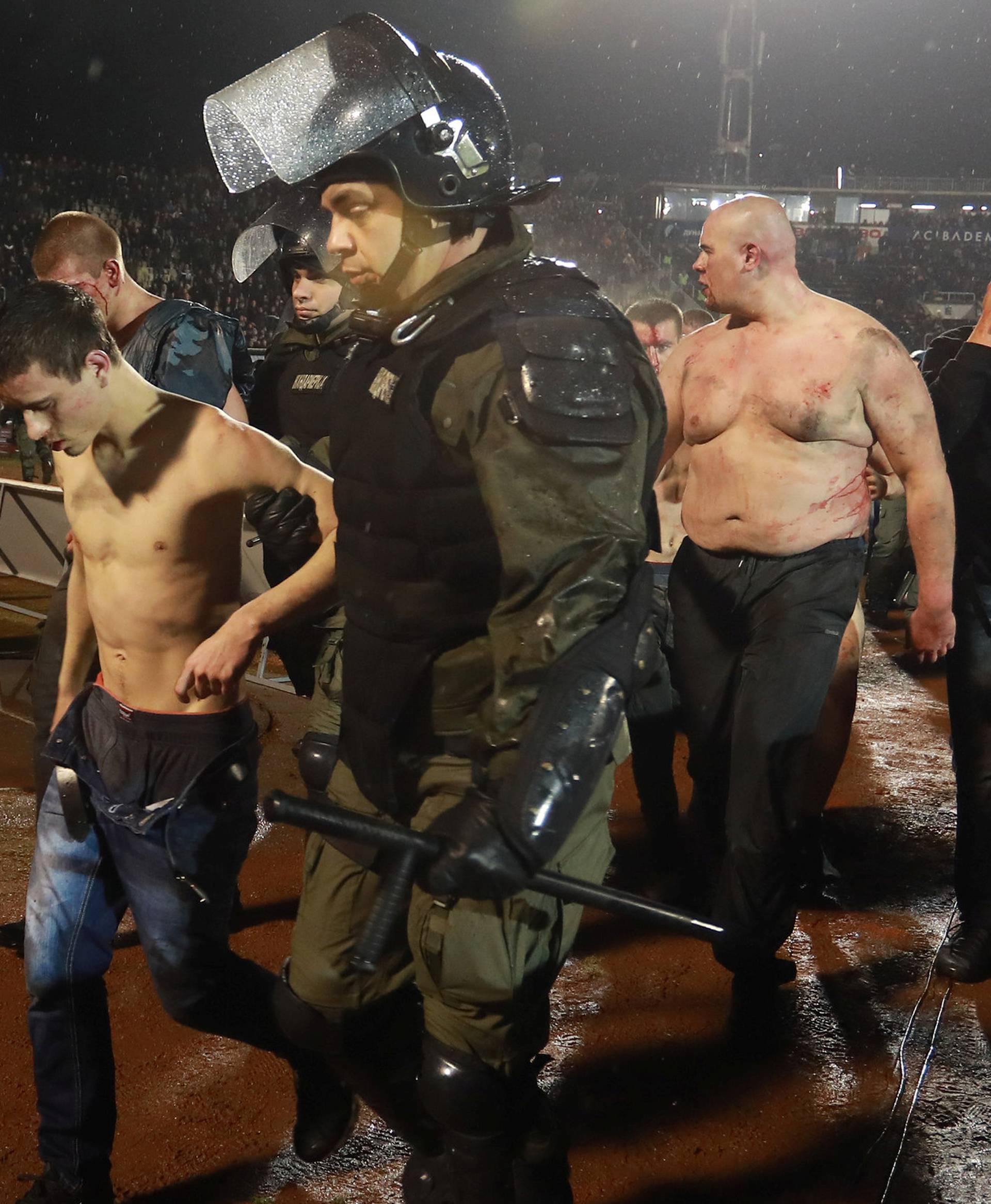 Police escort the soccer fans injured during the fights at a match between Red Star and Partizan in Belgrade