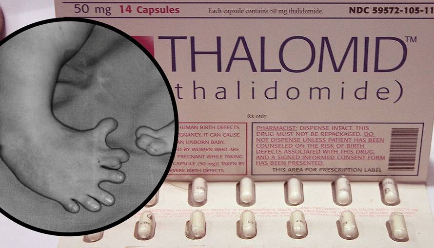 Zataškavali opasne nuspojave: Bebe rođene s deformacijama