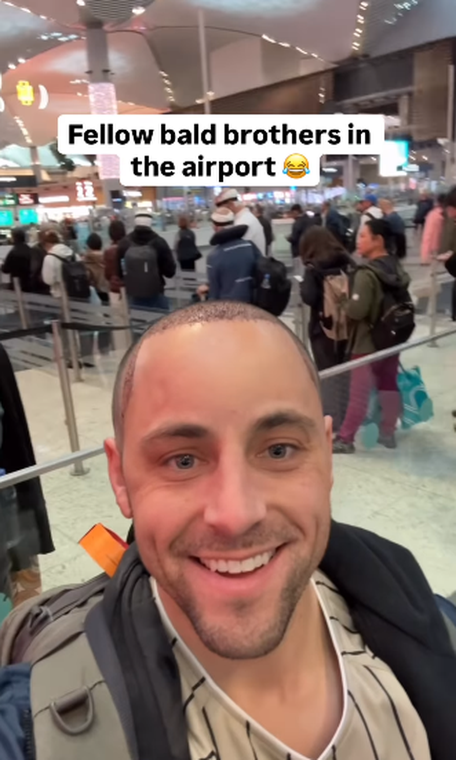 Trojčeki otputovali u Tursku na transplantaciju kose: 'Ne može samo jedan imati dobru frizuru'