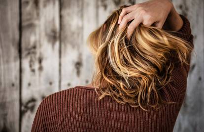 9 iznenađujućih razloga zašto se kosa masti - a nije zbog pranja
