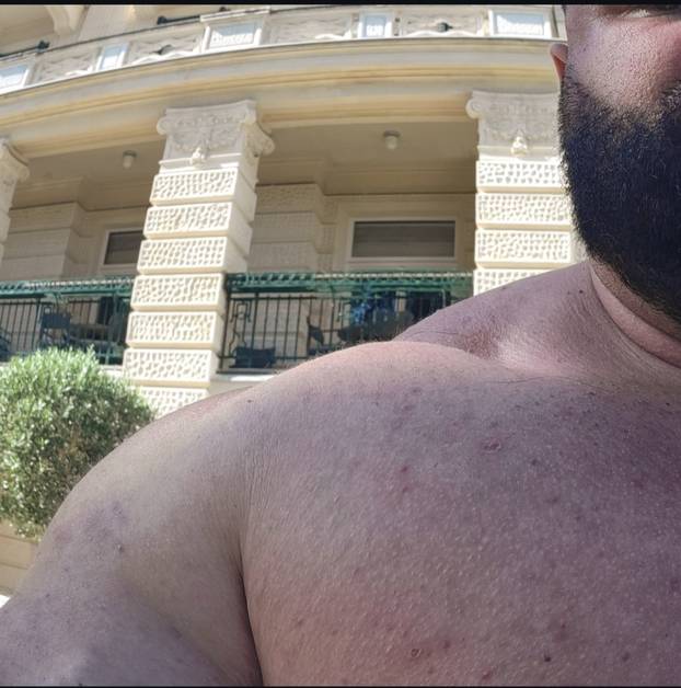 FOTO Ervin iz Big Brothera sada ima 175 kg: Bio je miljenik žena, a danas je neprepoznatljiv