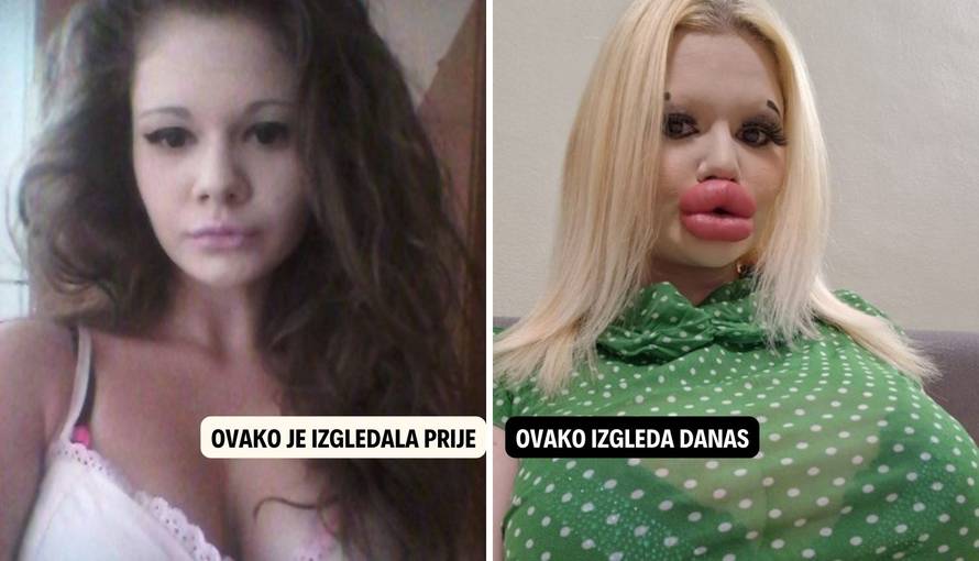 Potrošila je na tisuće eura da bi se 'proljepšala' i sad traži dečka