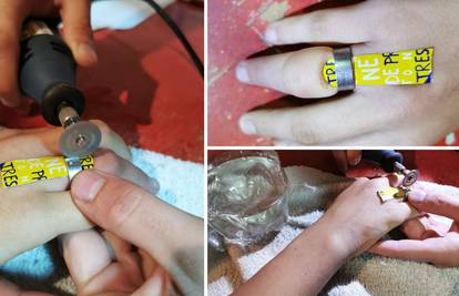 Zaglavio na prstu: Djetetu pilili brusilicom prsten sat vremena