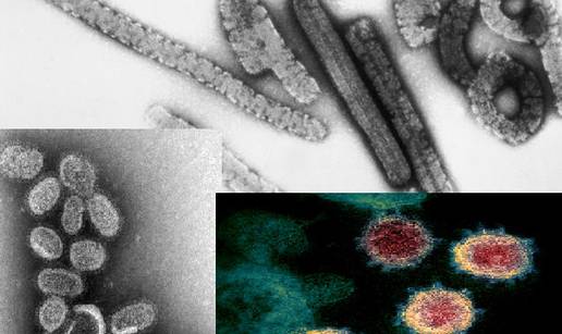 Top 12 najsmrtonosnijih virusa modernog doba - prijetnja su