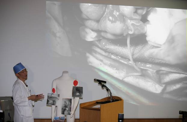 A surgeon Lee Cook-jong gives a briefing during a news conference at a hospital in Suwon