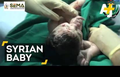 Porodili bebu kojoj se šrapnel zabio u glavu još u maternici
