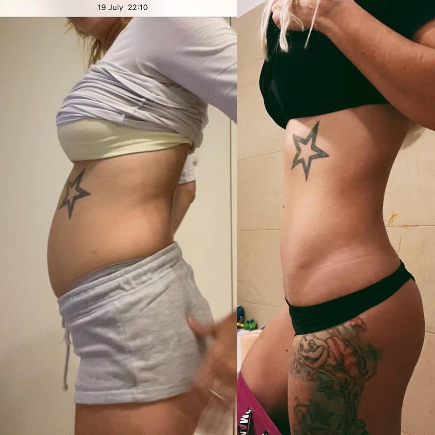 Ella Dvornik: 'Tek sada ću si napraviti guzicu kakvu želim'