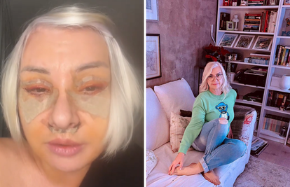 Danijela Dvornik šokirala! Evo kako izgleda nakon operacije: 'Ovo je još dobro kako je bilo!'