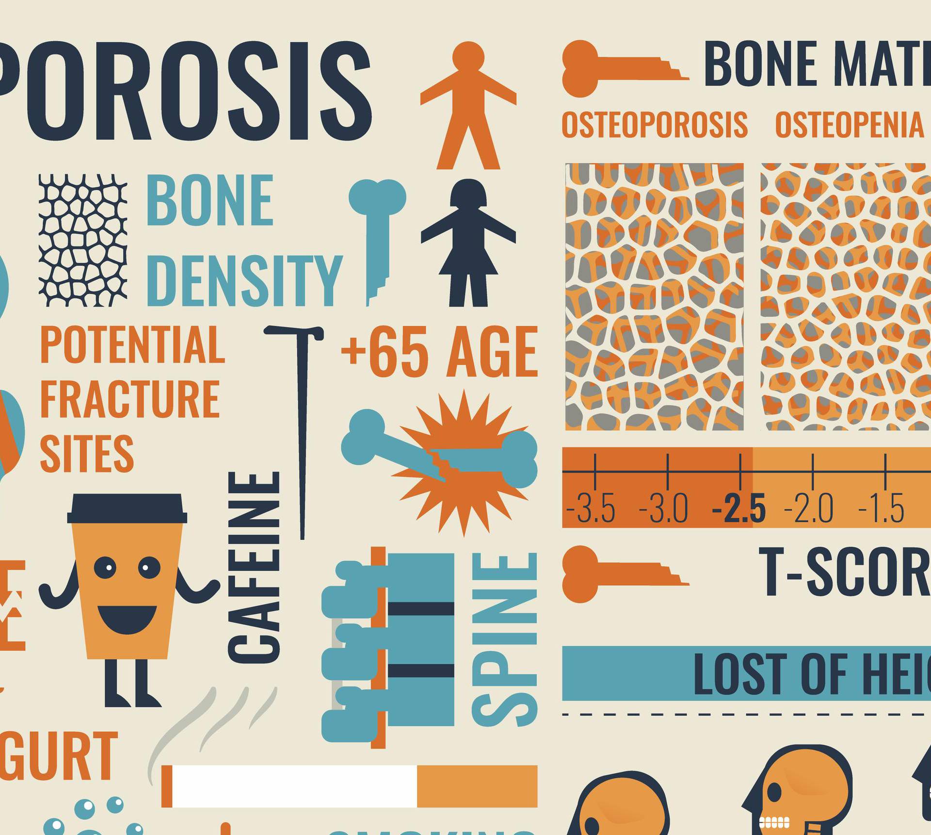 Čuvajte se: Osteoporoza jedna od 10 najčešćih bolesti danas