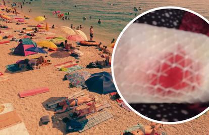 Pas napao ženu na plaži kraj Splita: "Izgrizao je dok je bila s unucima na moru. U šoku smo"