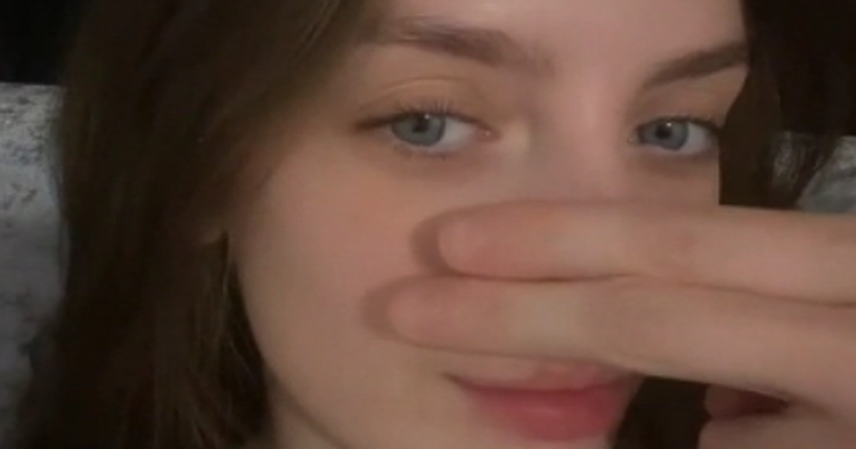 Okrutni ljudi govore da mi nos kvari lice, ali ne marim – zbog njega izgledam jedinstveno!