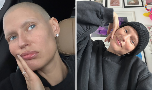 Model Bianca Balti otvoreno o životu nakon kemoterapije: Dobro sam, opet mi raste kosa!