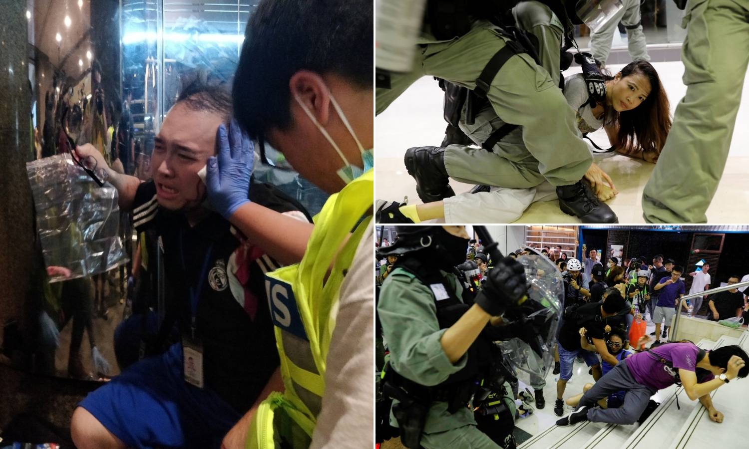 Neredi u Hong Kongu: Četvero napali nožem, odgrizeno uho...