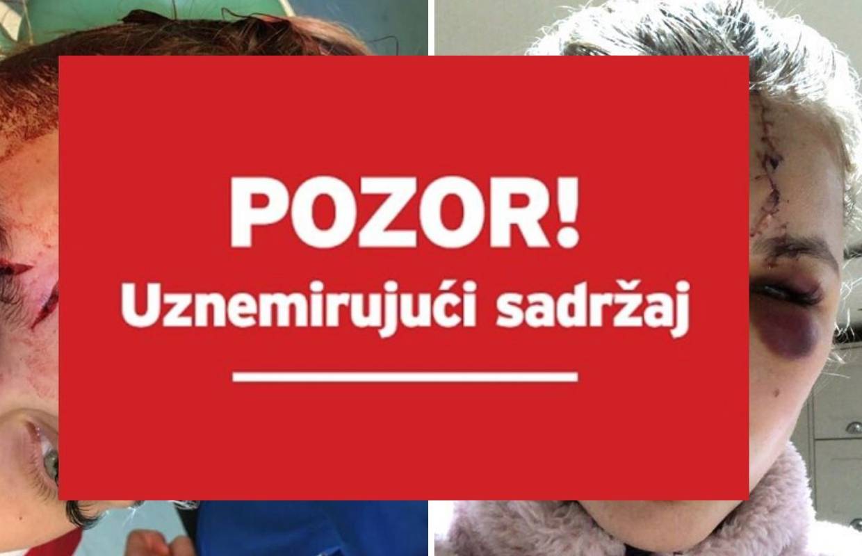Uf, ovo je boljelo! Suigračica ju je udarila kopačkom u glavu...