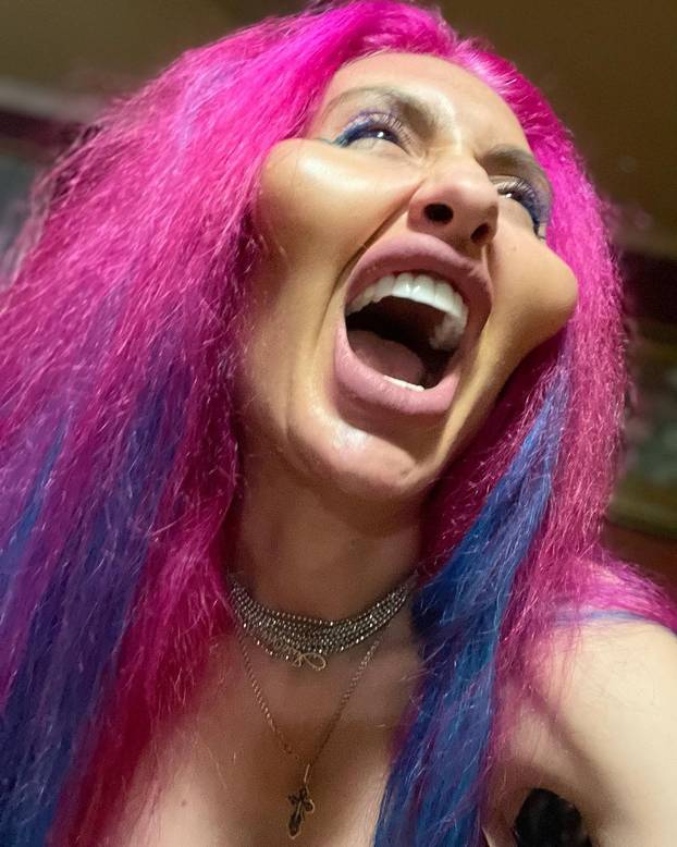 Žena s 'najvećim obrazima na svijetu' objavila fotografiju iz mladosti: 'Šok! Šteta ljepote'