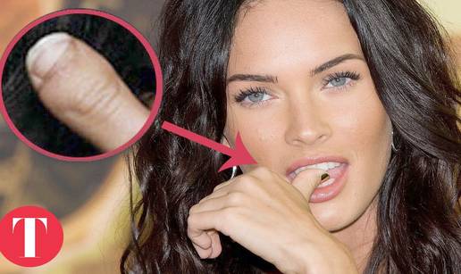 10 zvijezda koje nisu savr&scaron;ene - otkrijte njihove deformacije