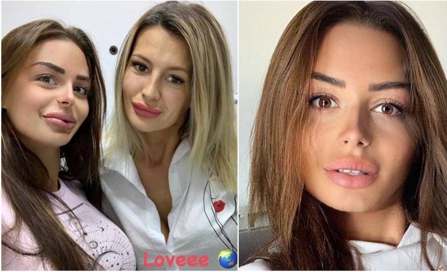 Mandarina je neprepoznatljiva: 'Jesi operirala nos? Uništena si'