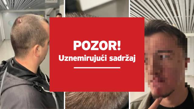 Srpska televizija objavila fotke pretučenih u Zadru. Policija je nastavila privoditi umiješane