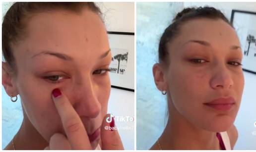 VIDEO Bella Hadid o izazovima nakon infekcije čeljusti: 'Molim vas, poslušajte svoje tijelo...'