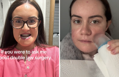 'Smijali su mi se i govorili da mi je čeljust ogromna, sada ću moći biti normalna djevojka'