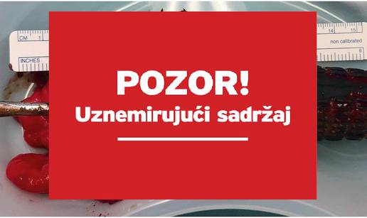 Završio u bolnici nakon tjedan dana s odvijačem u rektumu