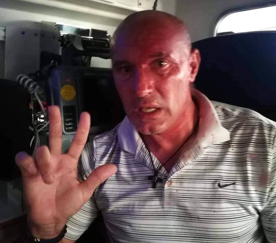 Ovo su češki Grobari pretučeni u Makarskoj, jedan krvave glave pozirao s tri uzdignuta prsta