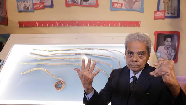 Shridhar Chillal of India displays his newly cut fingernails at an announcement that the five fingernails he grew for 66 years will be displayed in Ripley's Believe it or Not in New York
