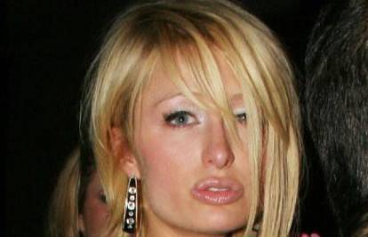 Paris Hilton 'napumpala' svoje usne kolagenom?