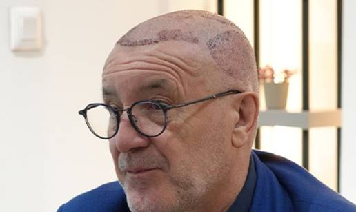 FOTO Stru&ccaron;njaci o presa&dstrok;ivanju kose: 'U Turskoj je to bilo dosta sumnjive kvalitete...'