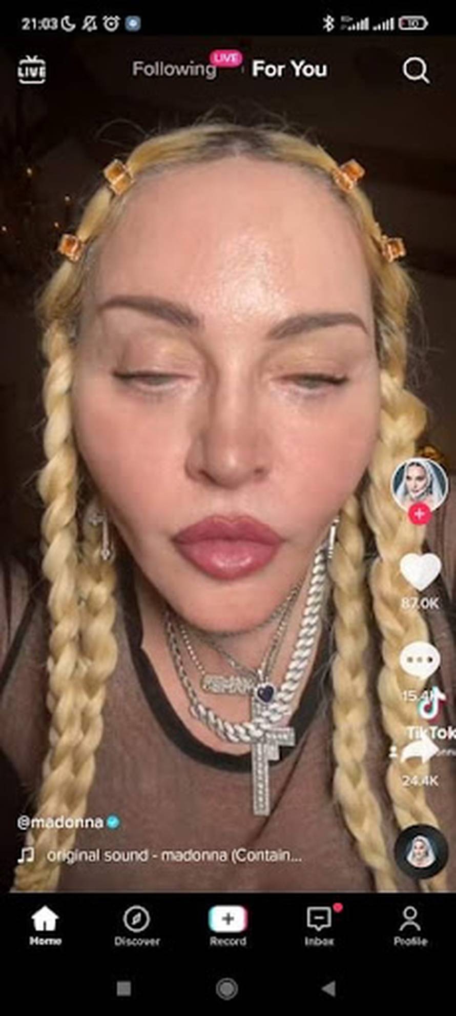 Madonna, što ti se dogodilo?