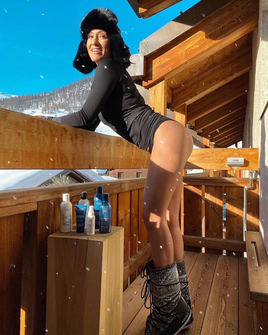 Kotiga 'prozvao' Hadžiavdagić zbog gole guze, ona se uzrujala