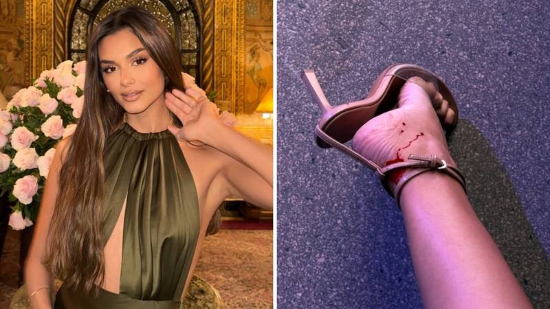 Misica Laura Gnjatović pokazala krvavo stopalo nakon zadarske revije: 'Ovo me zaboljelo...'