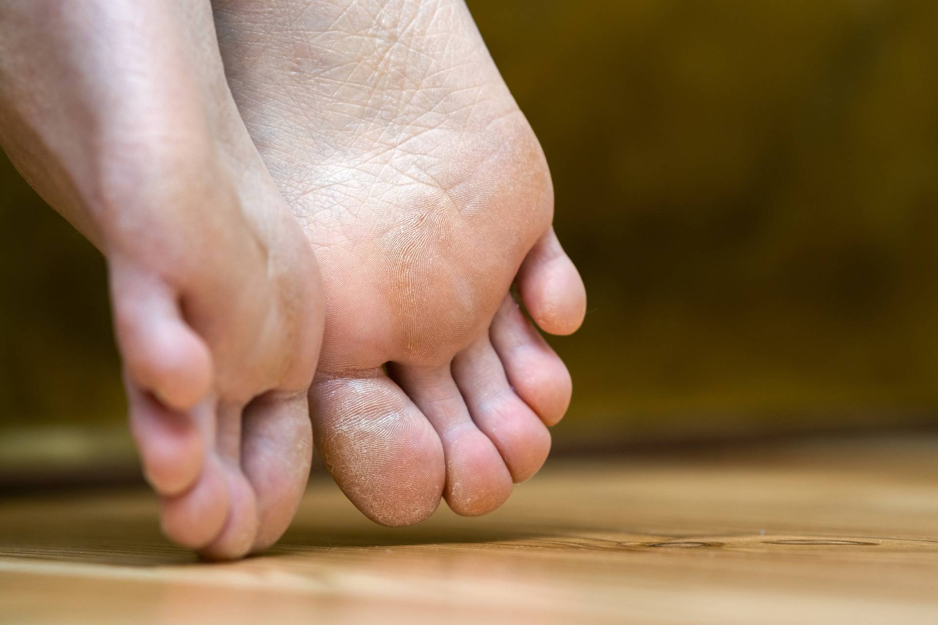 Obratite pažnju na stopala: Ona mogu ukazivati na neke bolesti