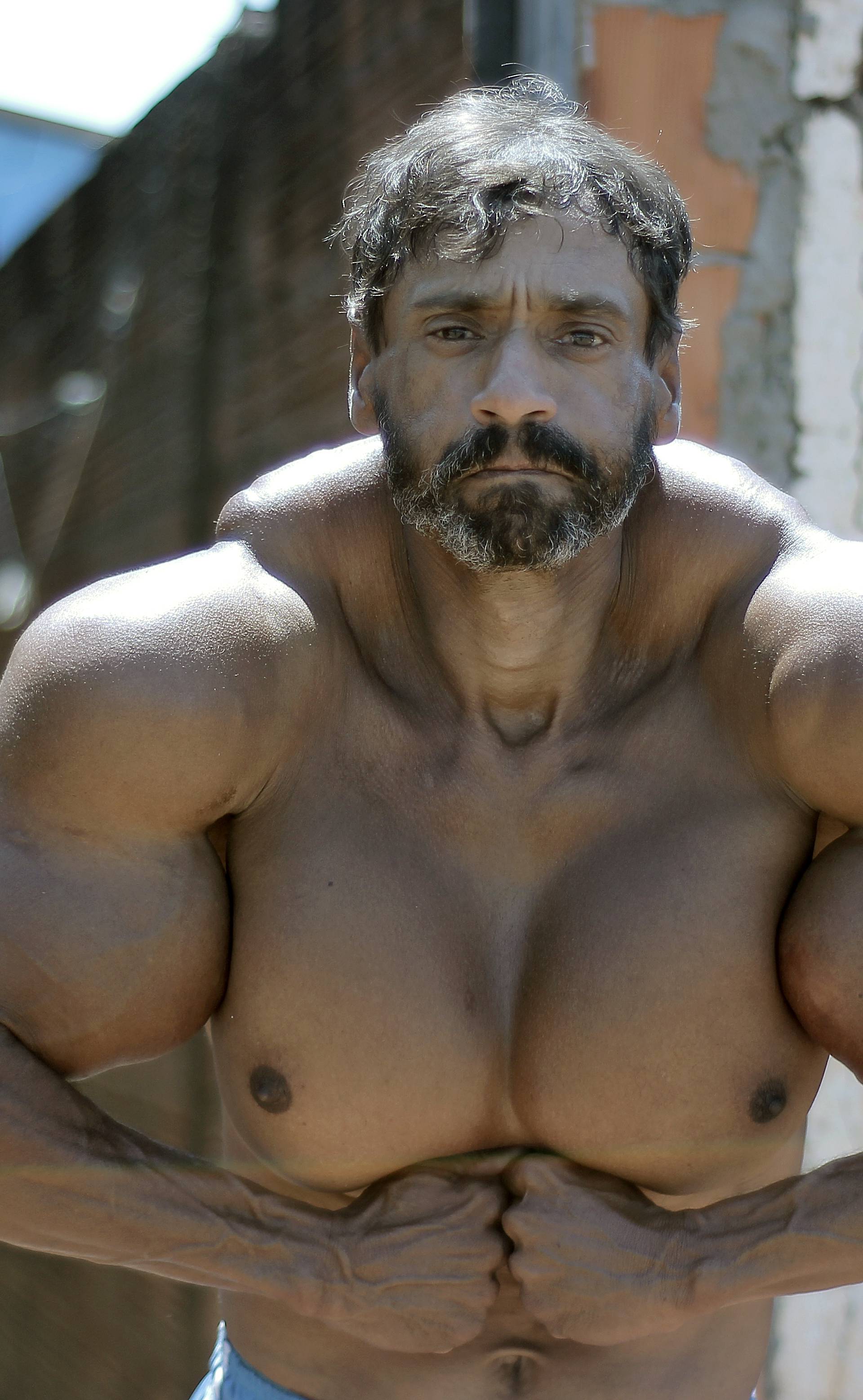 Incredible Bulk: Bodybuilder Injects Oil Into Enormous Muscles