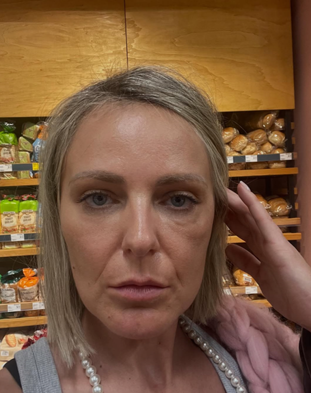 FOTO Ove slavne dame išle su pod nož: Neke su zablistale, drugima su zahvati uništili lice