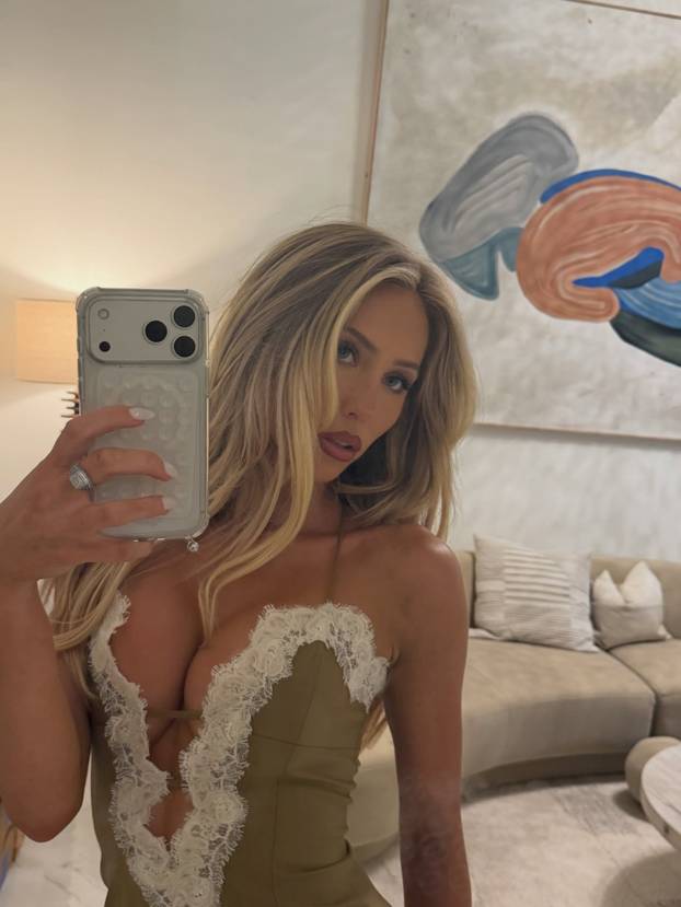 FOTO Pokazala nesavršenosti i zaludila internet: 'Želim da akne postanu seksi'