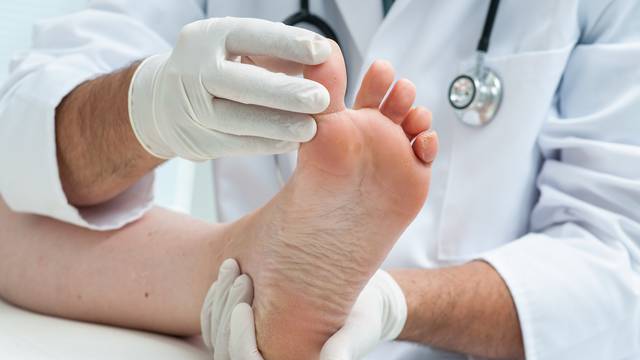 Što nokti na nogama govore o zdravlju: Dobro ih pogledajte