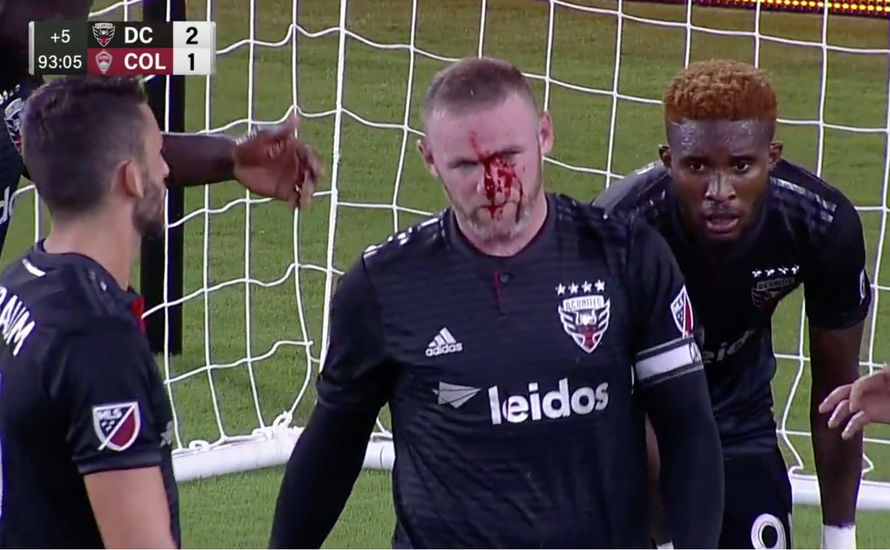 Neymare, gledaj!  Rooney  krvav i slomljen nije pravio dramu...