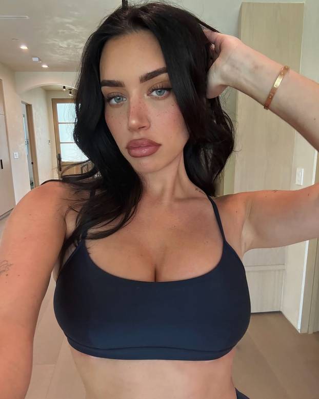 FOTO Milijuni uzdišu za njom: 'Smanjila sam i grudi i usne! Bio je to teret, svi su me osuđivali'