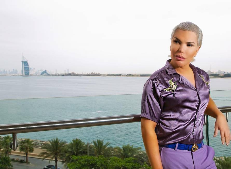 Ljudski Ken imao 11 operacija nosa: 'Ostat će ti rupa na licu'