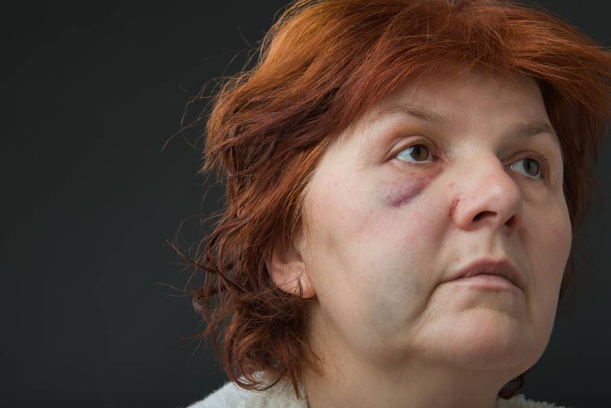 U sigurnim kućama više nema mjesta, a nasilje sve brutalnije