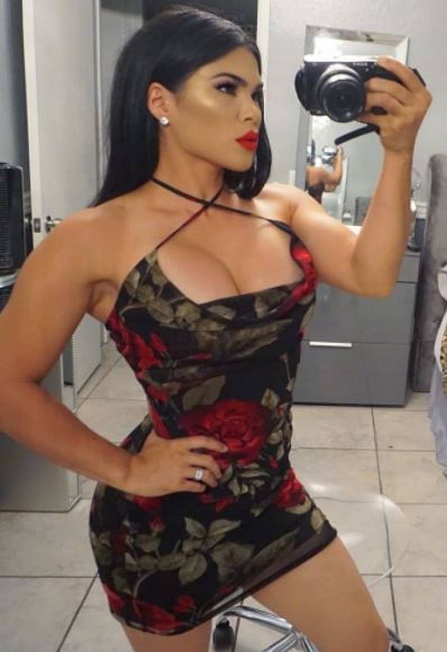 Pretučena UFC-ova ljepotica, sumnjaju  na obiteljsko nasilje