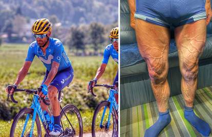 Pogledajte kako izgledaju noge biciklista nakon četiri sata utrke