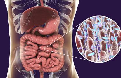 Bakterije u crijevima mogle bi biti 'krivac' za kronični umor