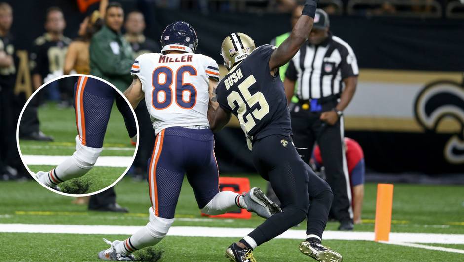 Uznemirujuća snimka iz NFL-a: Bore se da Milleru spase nogu