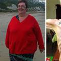 Od pretilosti do anoreksije: U dvije godine smršavila 120 kg