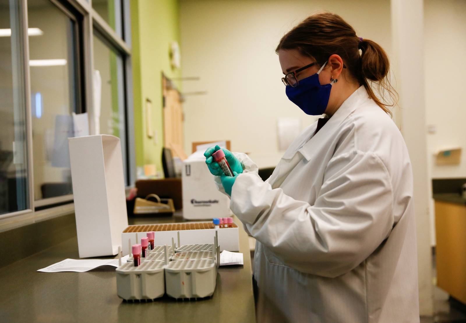 Plasma samples at Bloodworks in Renton