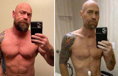 Prije i poslije korone: Bio je u bolnici 6 tjedana, izgubio 23 kg